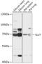Pre-mRNA-splicing factor SLU7 antibody, 18-004, ProSci, Western Blot image 