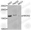 High Mobility Group Nucleosomal Binding Domain 2 antibody, A6156, ABclonal Technology, Western Blot image 