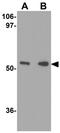 Tripartite motif-containing protein 30 antibody, GTX85385, GeneTex, Western Blot image 