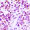 Tumor Necrosis Factor antibody, orb214681, Biorbyt, Immunohistochemistry paraffin image 
