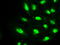 Premelanosome Protein antibody, GTX83640, GeneTex, Immunofluorescence image 