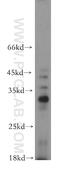 HAUS Augmin Like Complex Subunit 4 antibody, 20115-1-AP, Proteintech Group, Western Blot image 
