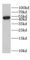 Cytochrome P450 Family 1 Subfamily B Member 1 antibody, FNab02149, FineTest, Western Blot image 