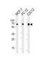 SRC Proto-Oncogene, Non-Receptor Tyrosine Kinase antibody, orb88818, Biorbyt, Western Blot image 