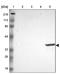 Ficolin 1 antibody, PA5-51437, Invitrogen Antibodies, Western Blot image 