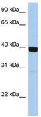 Zinc Finger Protein 385B antibody, TA339805, Origene, Western Blot image 