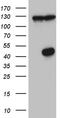 Histone deacetylase 8 antibody, TA809690, Origene, Western Blot image 