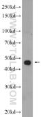 Serpin Family E Member 2 antibody, 11303-1-AP, Proteintech Group, Western Blot image 