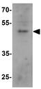 BCL3 Transcription Coactivator antibody, GTX31868, GeneTex, Western Blot image 