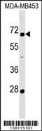 Zinc Finger Protein 565 antibody, 59-538, ProSci, Western Blot image 