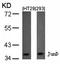 JunD Proto-Oncogene, AP-1 Transcription Factor Subunit antibody, orb14443, Biorbyt, Western Blot image 
