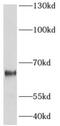 AarF Domain Containing Kinase 5 antibody, FNab00154, FineTest, Western Blot image 