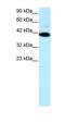 ZFP1 Zinc Finger Protein antibody, orb324379, Biorbyt, Western Blot image 