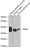 Tropomyosin 3 antibody, GTX16386, GeneTex, Western Blot image 