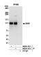 EWS RNA Binding Protein 1 antibody, NB200-182, Novus Biologicals, Western Blot image 