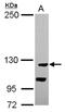 Cation Channel Sperm Associated Auxiliary Subunit Beta antibody, NBP2-15728, Novus Biologicals, Western Blot image 