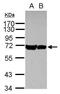 Heat shock 70 kDa protein 1A/1B antibody, PA5-29605, Invitrogen Antibodies, Western Blot image 