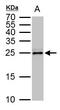 p24 antibody, PA5-31492, Invitrogen Antibodies, Western Blot image 