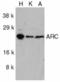 Nucleolar Protein 3 antibody, TA305985, Origene, Western Blot image 