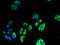 Flavin Containing Dimethylaniline Monoxygenase 4 antibody, A62602-100, Epigentek, Immunofluorescence image 