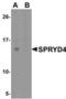 SPRY Domain Containing 4 antibody, NBP1-77100, Novus Biologicals, Western Blot image 