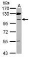 Zinc Finger Protein 512B antibody, GTX120094, GeneTex, Western Blot image 