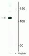 Microprocessor complex subunit DGCR8 antibody, P00475, Boster Biological Technology, Western Blot image 