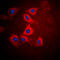 Hexosaminidase Subunit Beta antibody, GTX55224, GeneTex, Immunocytochemistry image 