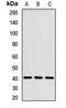 Alcohol Dehydrogenase 1C (Class I), Gamma Polypeptide antibody, LS-C667692, Lifespan Biosciences, Western Blot image 