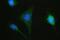Hyaluronan Synthase 1 antibody, A04784-1, Boster Biological Technology, Immunofluorescence image 