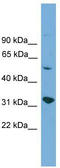 Yip1 Domain Family Member 2 antibody, TA338642, Origene, Western Blot image 