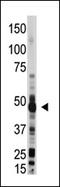 2'-5'-Oligoadenylate Synthetase 1 antibody, AP13200PU-N, Origene, Western Blot image 