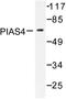 Protein Inhibitor Of Activated STAT 4 antibody, AP06455PU-N, Origene, Western Blot image 