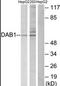 Disabled homolog 1 antibody, AP39027PU-N, Origene, Western Blot image 