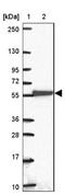 Leucine Rich Repeat Containing 36 antibody, NBP2-31597, Novus Biologicals, Western Blot image 