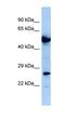 NADH dehydrogenase [ubiquinone] iron-sulfur protein 8, mitochondrial antibody, orb331152, Biorbyt, Western Blot image 