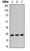 Heat Shock Protein Family B (Small) Member 1 antibody, orb338948, Biorbyt, Western Blot image 