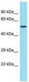 Kelch Like Family Member 33 antibody, TA337396, Origene, Western Blot image 