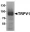 Transient receptor potential cation channel subfamily V member 1 antibody, TA319735, Origene, Western Blot image 