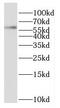 Oxidative Stress Responsive Kinase 1 antibody, FNab06055, FineTest, Western Blot image 