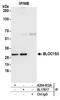 Biogenesis Of Lysosomal Organelles Complex 1 Subunit 3 antibody, A304-612A, Bethyl Labs, Immunoprecipitation image 