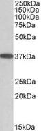 Monoacylglycerol O-Acyltransferase 2 antibody, LS-B9222, Lifespan Biosciences, Western Blot image 