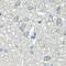 Glucosamine--fructose-6-phosphate aminotransferase [isomerizing] 1 antibody, FNab03436, FineTest, Immunohistochemistry frozen image 