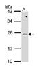 Rac Family Small GTPase 2 antibody, LS-C109505, Lifespan Biosciences, Western Blot image 