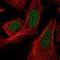 Adrenocortical dysplasia protein antibody, NBP2-58187, Novus Biologicals, Immunofluorescence image 