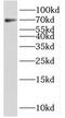 PML antibody, FNab06745, FineTest, Western Blot image 