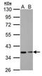NF-kappa-B inhibitor alpha antibody, TA308928, Origene, Western Blot image 