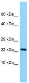 Mimitin, mitochondrial antibody, TA337768, Origene, Western Blot image 