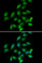 Protein Phosphatase 2 Catalytic Subunit Alpha antibody, 22-419, ProSci, Immunofluorescence image 