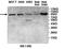 Ubiquitin Specific Peptidase 5 antibody, orb78176, Biorbyt, Western Blot image 